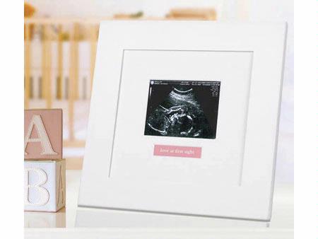 Sonogram Frame - click to enlarge Sonogram Frame